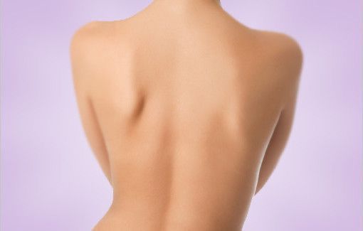 Peeling Químico Escote